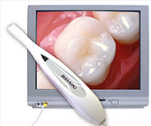Link to more info about Intraoral Camera